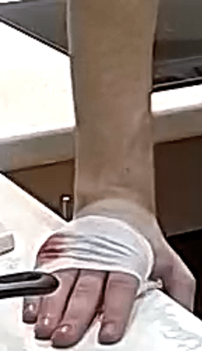Waynes hand injured how