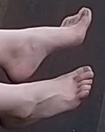 feet Alisa 12-22-22