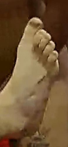foot Fernanda 5-24-22