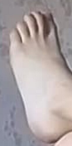 foot Barbara 8-13-22