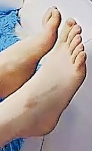 feet Rose 3-15-23