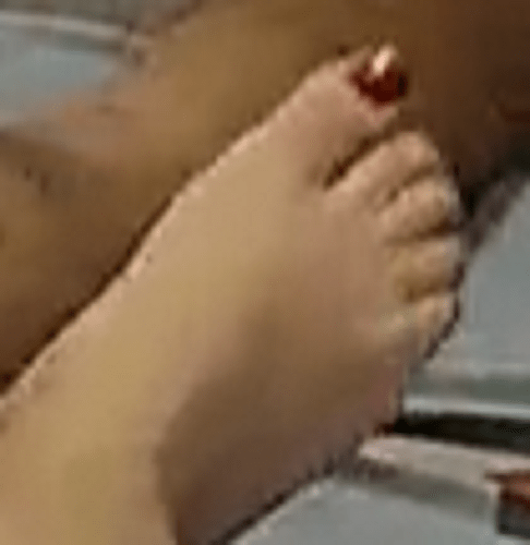 foot Arya 8-19-22 5