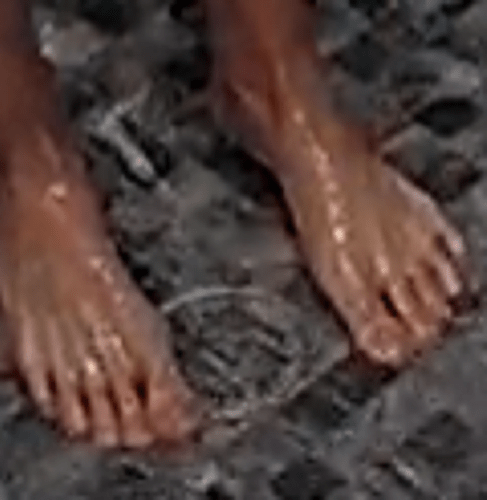 feet Roisin 8-2-22 2