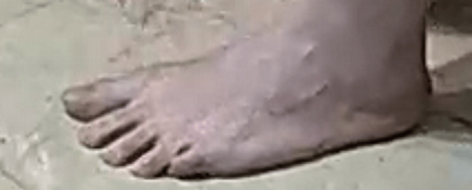 foot Ary 6-28-19