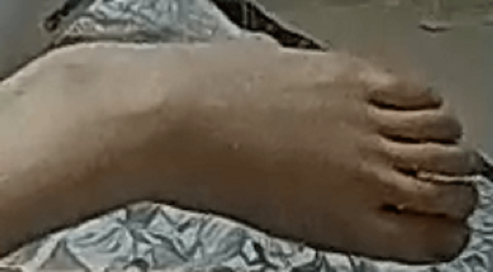 Foot Ashley 2