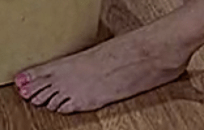 foot Alisa 9-15-22