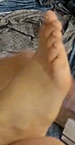 foot Flora 2-12-23