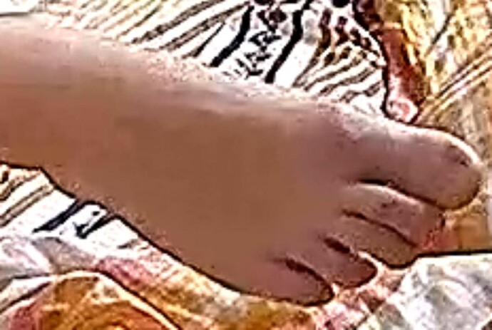 foot Alina 2-10-17 3