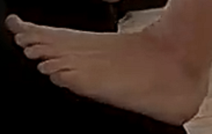 foot Barbara 7-5-22 2