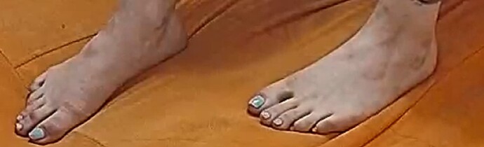 feet Sanita 6-3-22