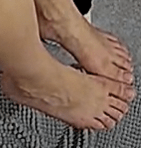feet Lyla 1-13-23