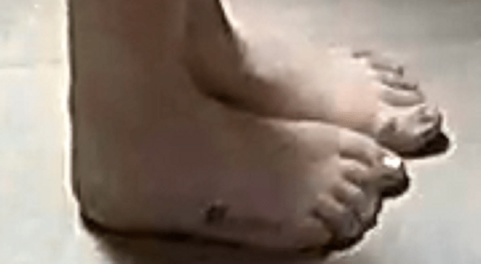 feet Marica 11-4-22 2