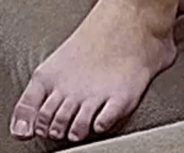 foot Ariela 12-22-22