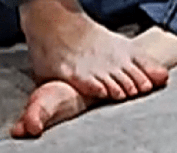 feet Viola 10-2-22
