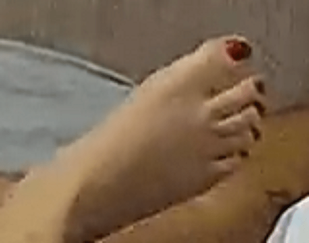 foot Arya 8-19-22 8