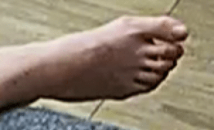 foot Foxy Lee 10-29-22
