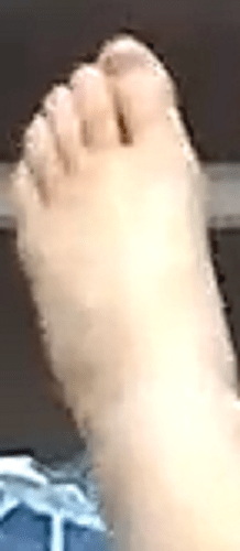 foot Alana 4-30-22