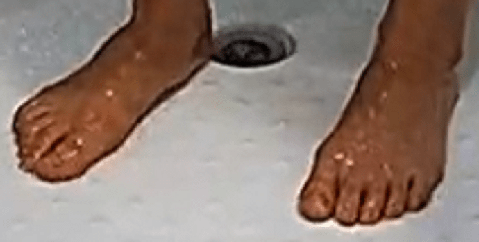 feet Auriel 7-8-22 3