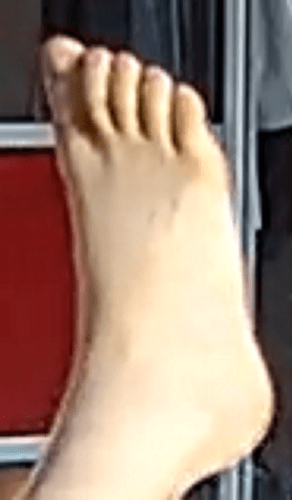 foot Alana 7-13-22 4