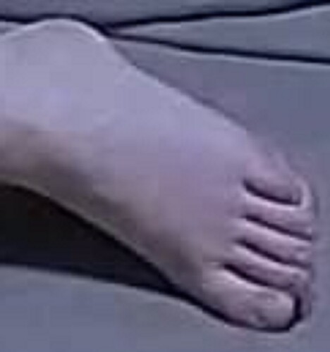 foot Annabella 2-17-23