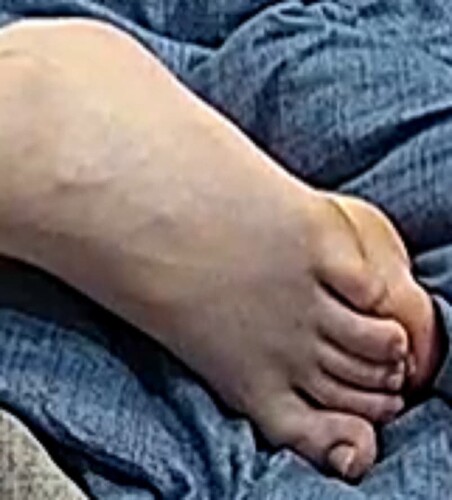 feet Astrid 6-26-22