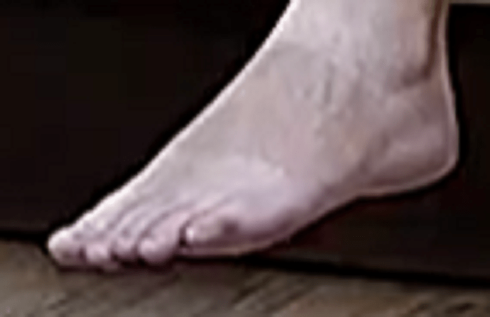 foot Ariela 7-20-22