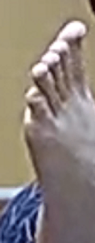 foot Ariela 1-14-23 5