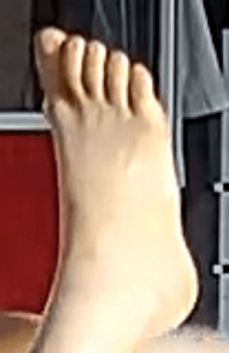 foot Alana 7-13-22 2