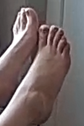 feet Goldie 11-23-22