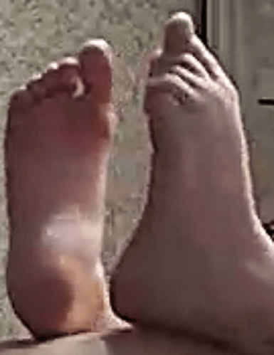 feet Diu 6-6-22 1
