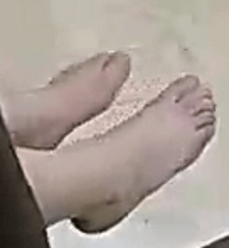 feet J&T unknown 7-3-22