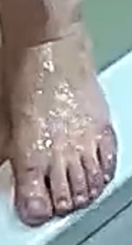 foot Alana 7-21-22