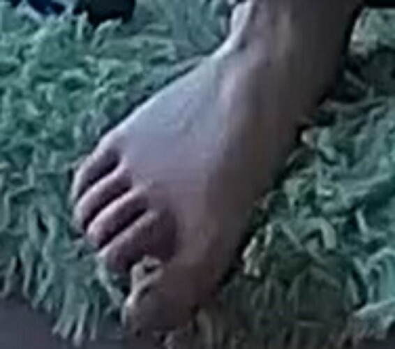 foot Annabella 2-14-23 R