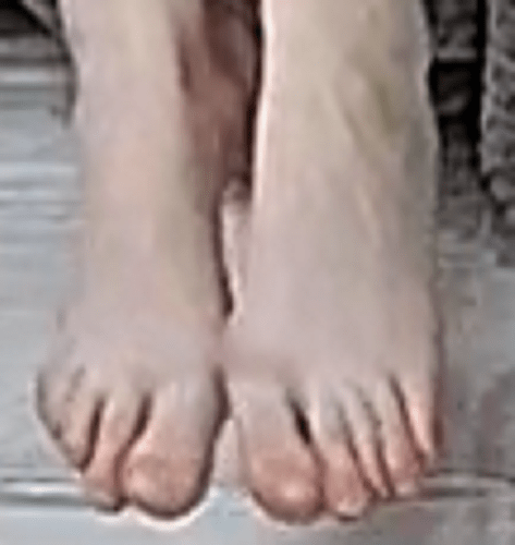feet nknown 2-18-22