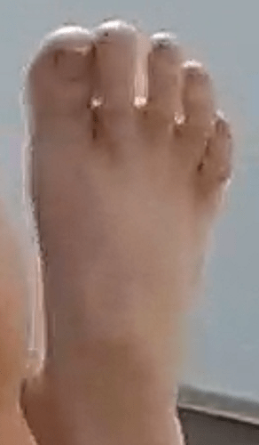 foot Ailya 7-10-22 5