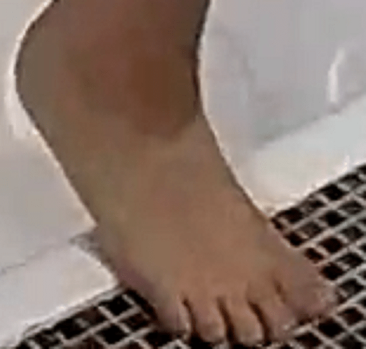 foot Chyna 8-14-22