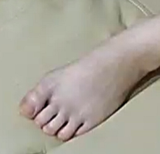 foot Astrids BFF 6-14-22