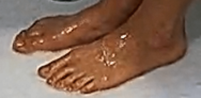feet Auriel 7-8-22