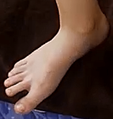 Foot Barbara R 7-5-22