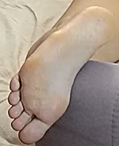 foot Flora 4-28-22