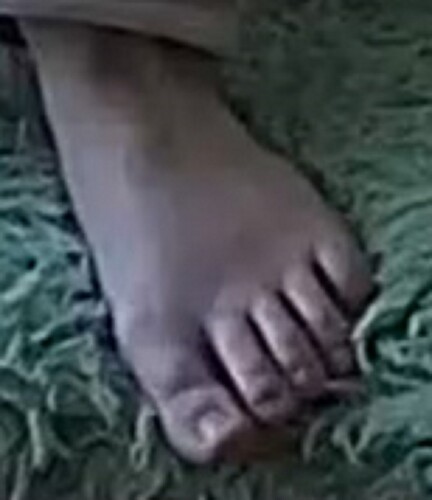 foot Annabella 2-14-23 L