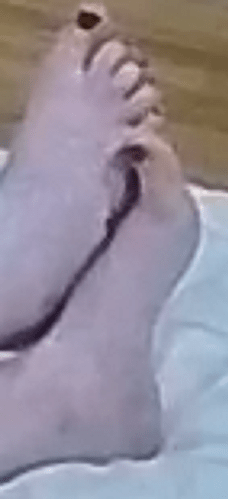 feet Marica 7-21-22