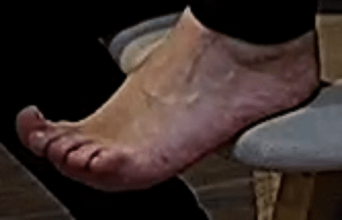 foot Goldie 10-19-22