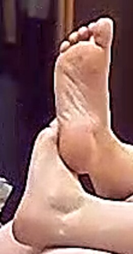 feet Em 3-7-17