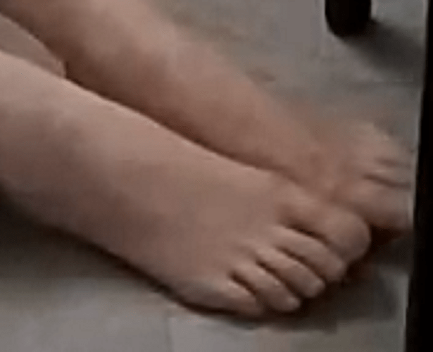 foot Debby 6-23-22 2