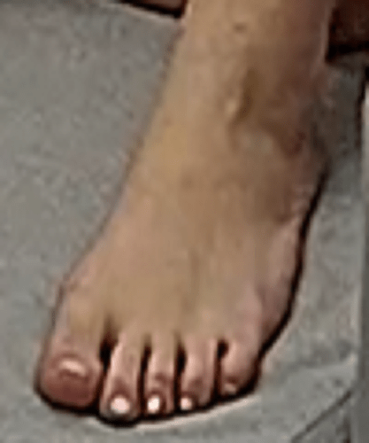 foot Goldie 1-15-23