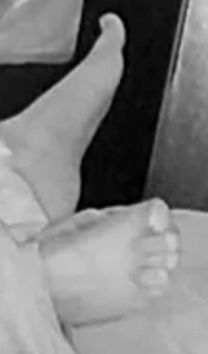 feet Kirsten dark 8-15-22
