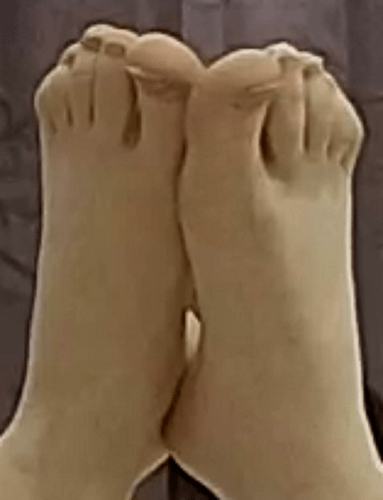 feet Wendy 2-28-23 2