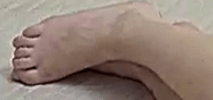 feet Lyla 1-26-23
