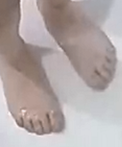 feet Ingrid 10-22-22